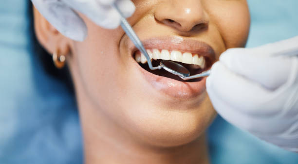 Best Dentist for Tooth Abscess  in Barnhart, MO