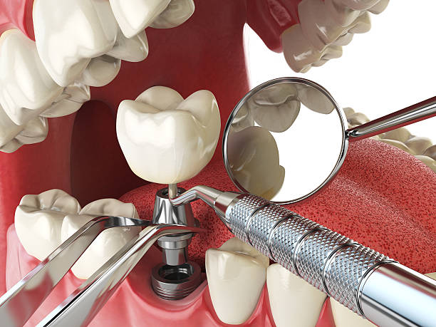 24-Hour Dental Clinic Near Me in MO